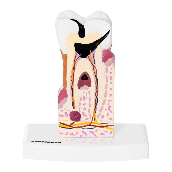 Slima zoba zoba anatomiskais modelis skalā 6: 1