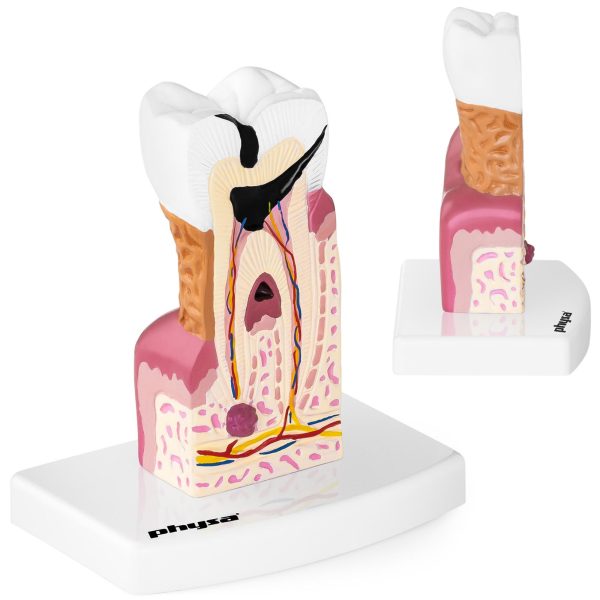 Slima zoba zoba anatomiskais modelis skalā 6: 1